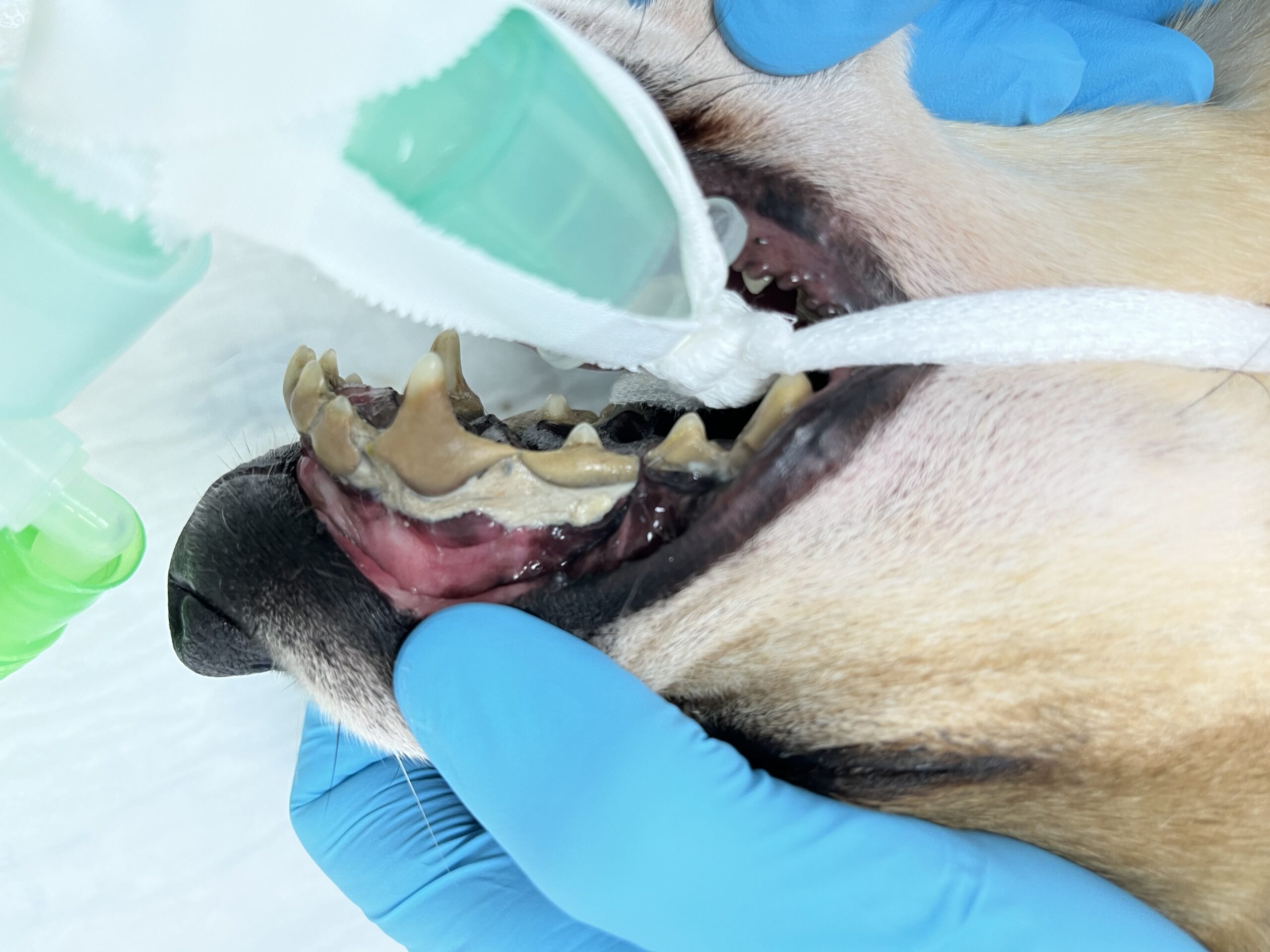Dental care