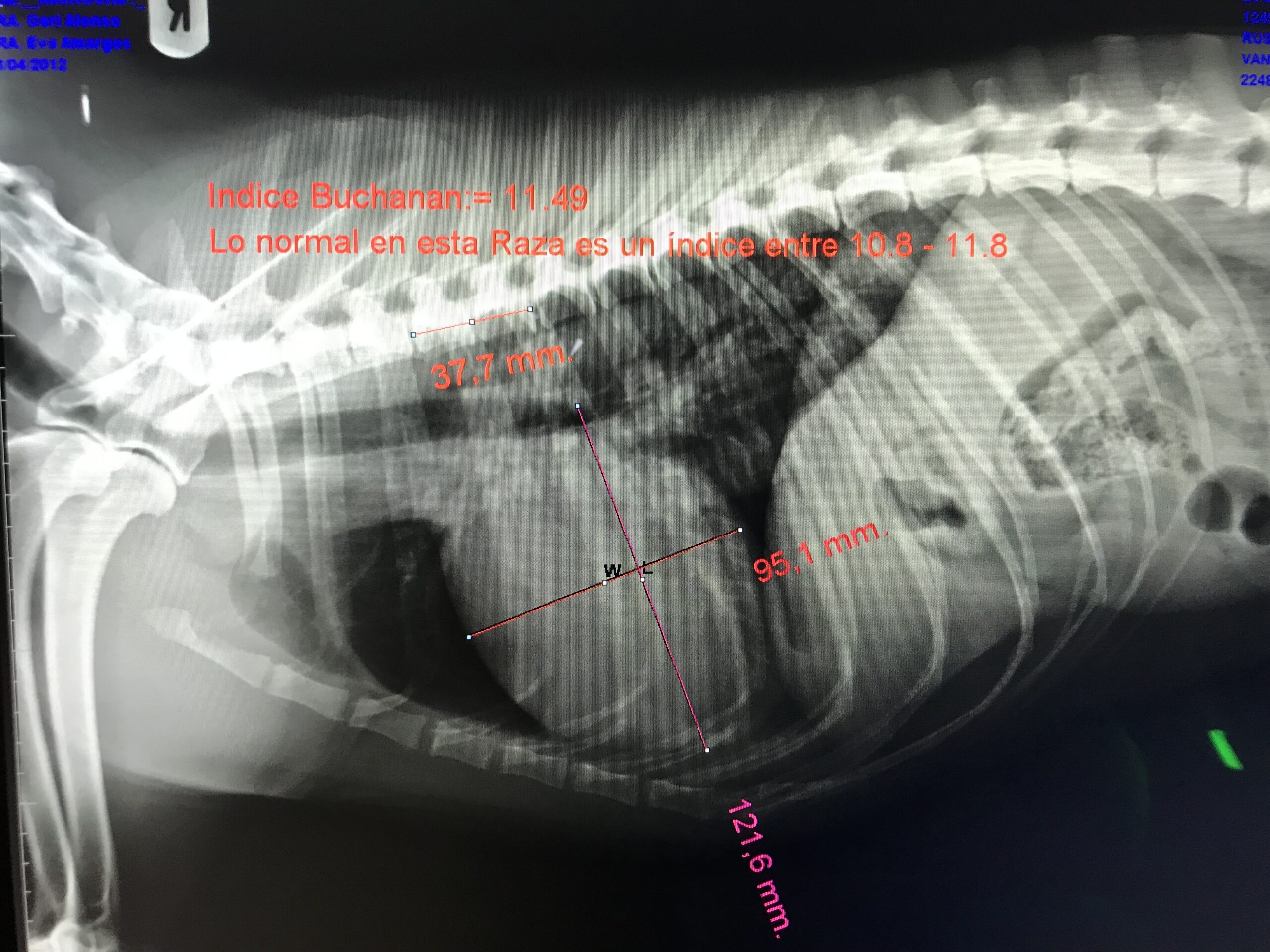 Radiografías